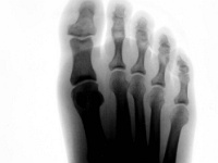 MyFoot_Pos-enh.jpg