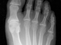 PEFoot2.jpg
