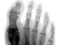 PEFoot2_Pos-enh.jpg