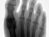 PEFoot_Pos-enh.jpg