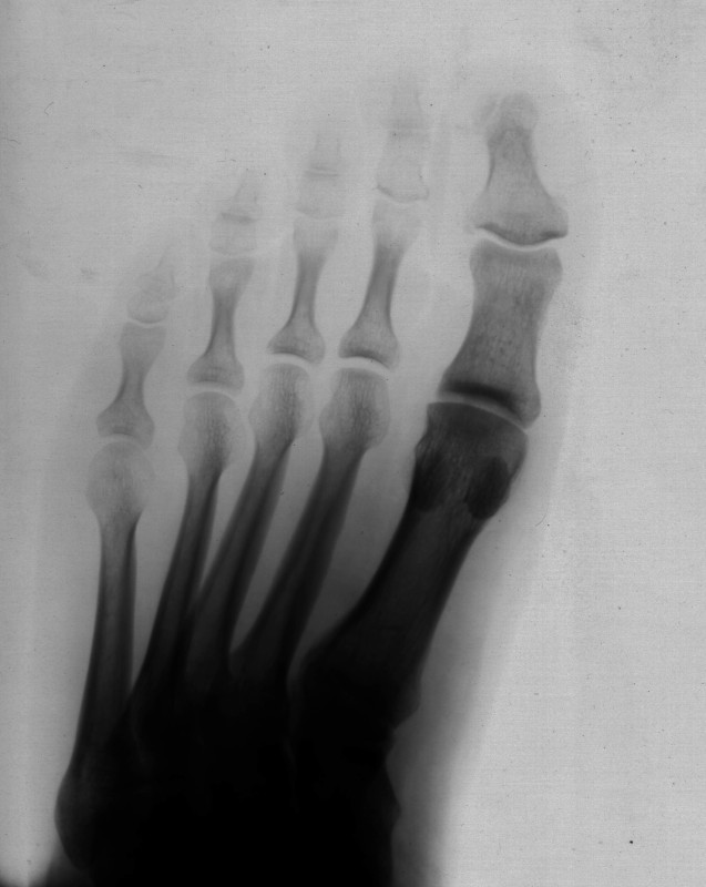 Click for original image